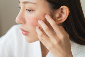 Argan Oil for Eczema: Does It Really Work?