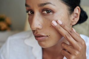 Argan Oil benefits for acne