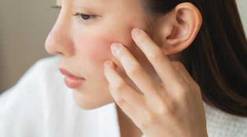 Argan Oil for Eczema: Does It Really Work?
