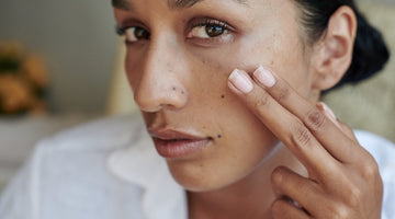 Argan Oil benefits for acne